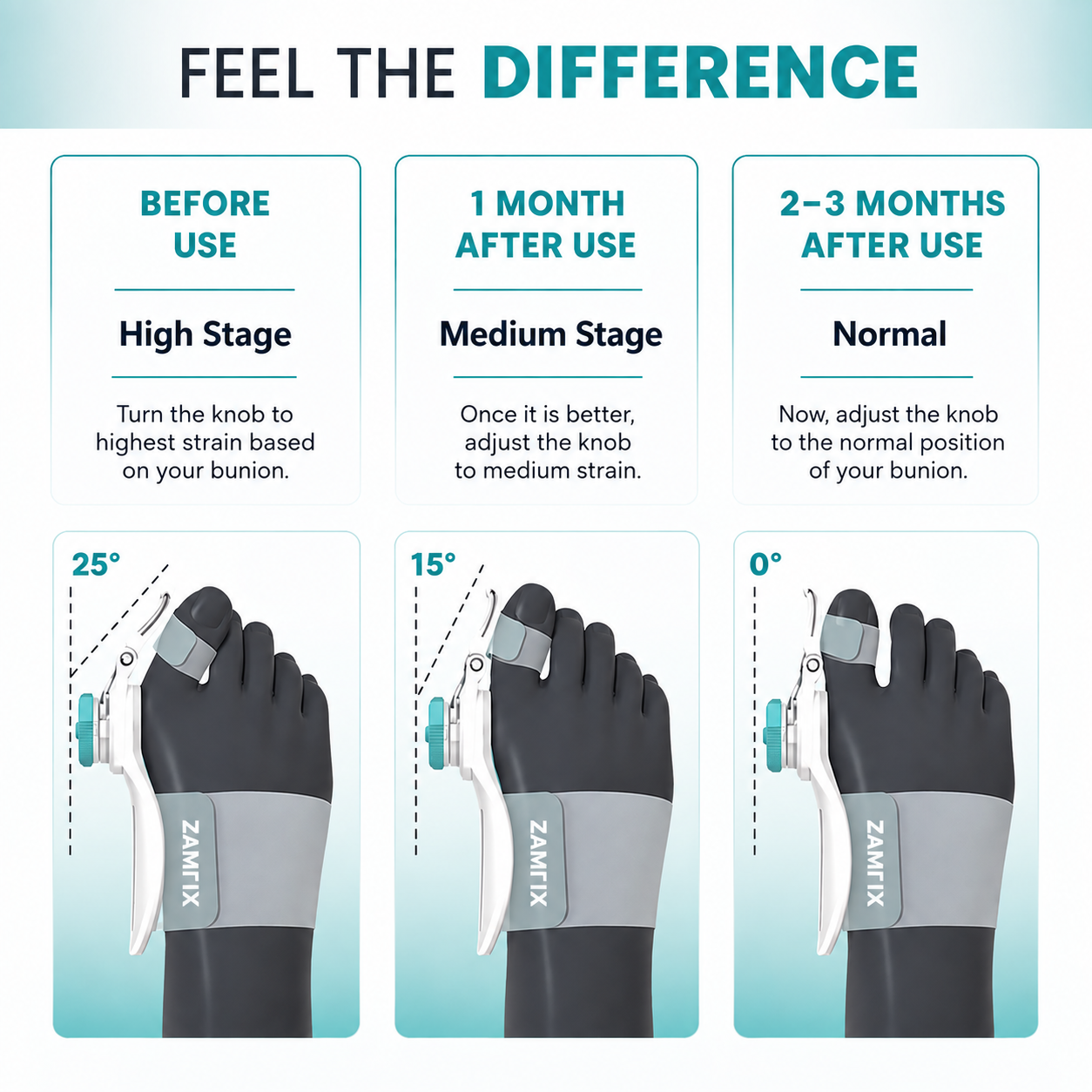 ZAMLIX Bunion Corrector Brace | Adjustable Toe Straightener for Hallux Valgus